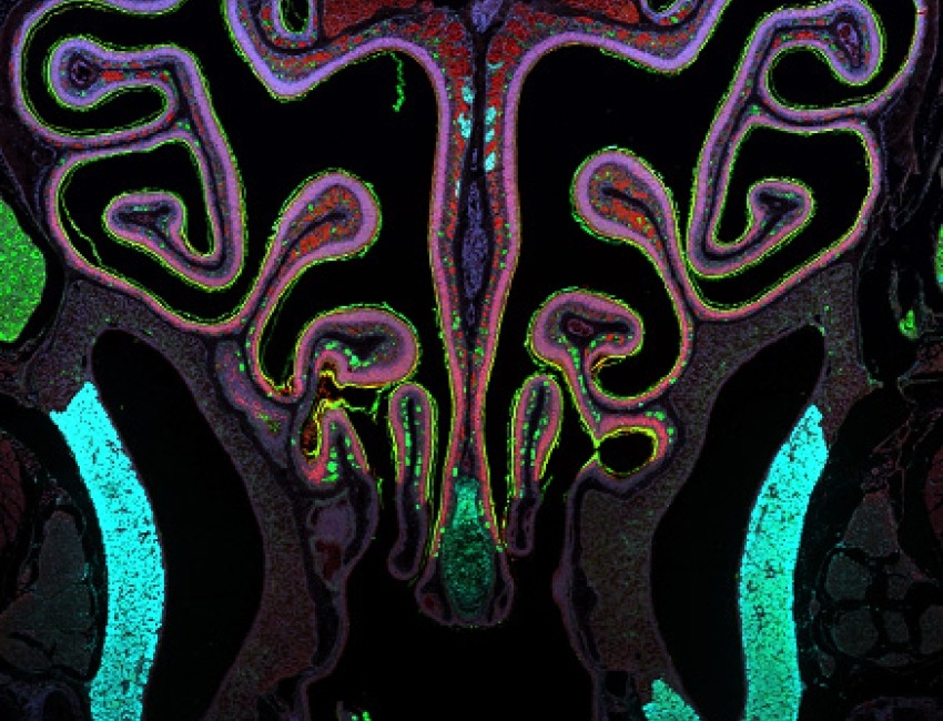 Cells of the mouse sinus and nasal passages indicated with a rainbow of colors.