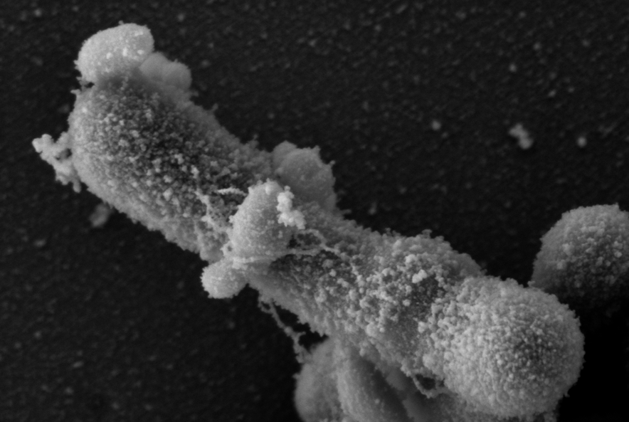 Sphere-shaped TM7x bacteria (light gray) are physically bound to the rod-like S. odontolytica. The two microbes live a symbiotic lifestyle. 
