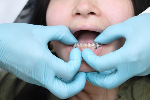 The clinical trial tests whether clear aligners can correct teeth misalignments in patients with brittle teeth due to osteogenesis imperfecta. | NIDCR