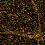 Sprinkled like confetti throughout this image are dozens of green-, yellow-, and red-ringed axons—nerve fibers that transmit electrical signals throughout the nervous system. 