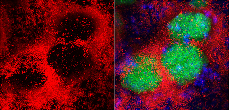 S. sputigena cells (red) form a honeycomb-like structure (left) that encapsulates S. mutans (green) to increase and concentrate the acid production that boosts cavity development (right).
