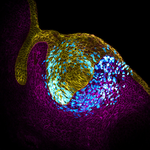 Pressure from multiplying cells (cyan) triggers the formation of the tooth command center known as the enamel knot (area surrounded by cyan). The knot directs tooth development within the tooth bud (yellow and magenta).