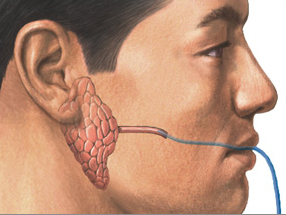 Diagram of contrast medium injected into the parotid gland duct