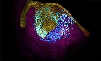 Tooth epithelium (cell surface; yellow) and mesenchyme (cell surface; magenta). Proliferating cells (cyan) expand the tissue, generating a mechanical pressure at the tissue center that drives the formation of the main tooth signaling center or organizer, the enamel knot.