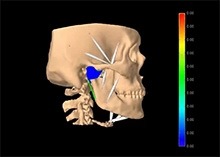 The researchers used computer models to simulate how shape differences in the jawbone could affect mechanical stress on the jaw joint.