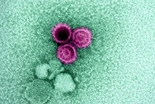 An electron micrograph showing three Epstein-Barr virus (EBV) particles colorized pink. 