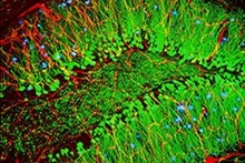 Mouse brain showing hallmarks of Alzheimer’s disease (amyloid plaques in blue) with blood vessels (red) and nerve cells (green).
