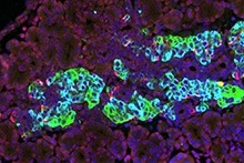 Image of cells in an embryonic mouse pancreas and three principal endocrine hormones: Beta cells making insulin (sky blue), alpha cells making glucagon (green), and delta cells making somatostatin (red) with the fluorescent stain DAPI shown in blue identifying nuclei.