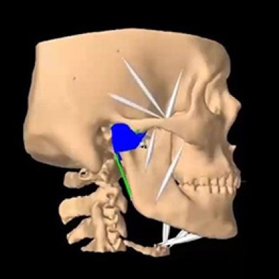 Computer model of a skull and temporomandibular joint.