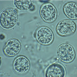 Microscopic enlargement of Toxoplasma gondii. 